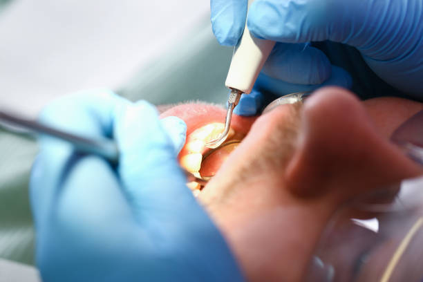 Tooth Infection Emergency Dentist in FL